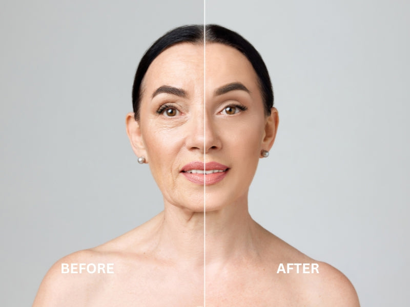 before and after results of using Opul's Anti Ageing natural skincare