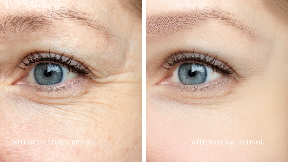 NATURAL RETINOL YOUTH SERUM